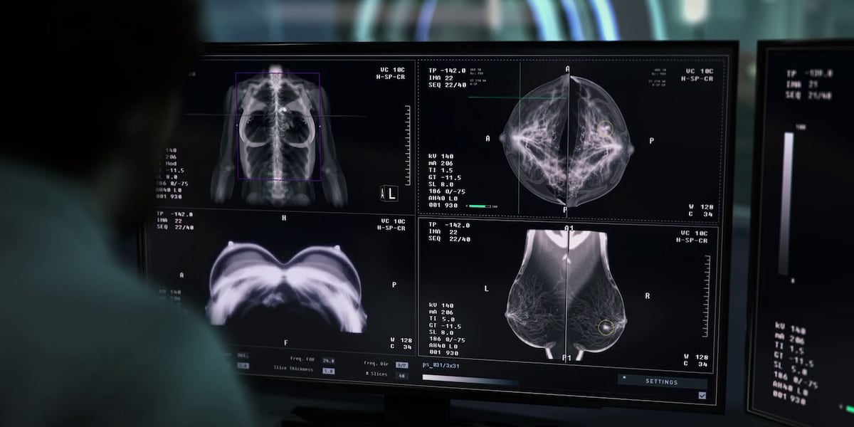 The Pink Shift: More women under 40 battling breast cancer