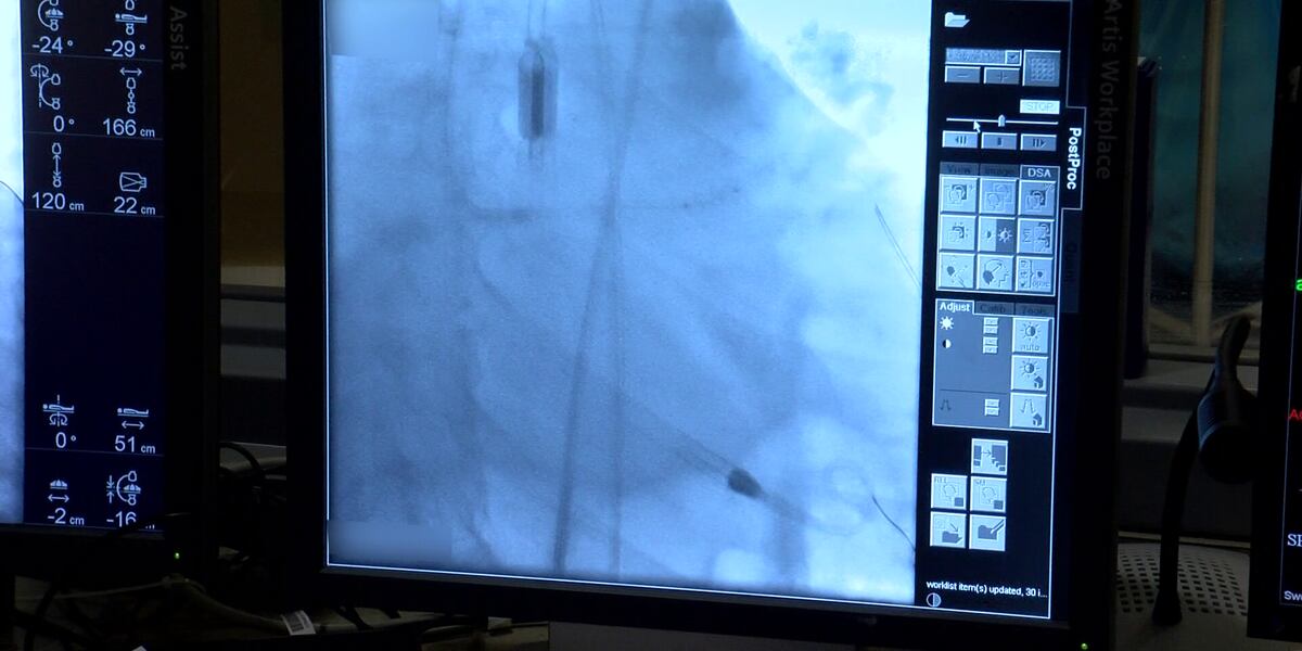 Calcium Scan Spectroscopy What’s Your Score? How knowing your coronary calcium scan could save ...