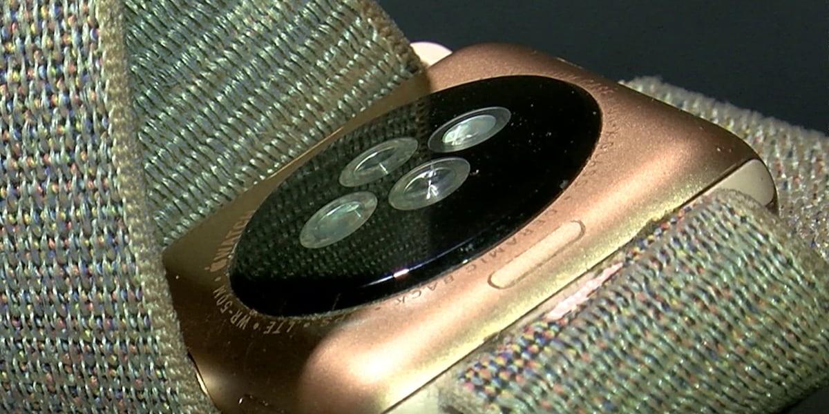 Apple Watch Creating Rash Mid-South teen’s Apple Watch triggers rash