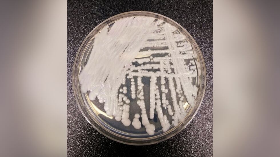 FILE - This undated photo made available by the Centers for Disease Control and Prevention...