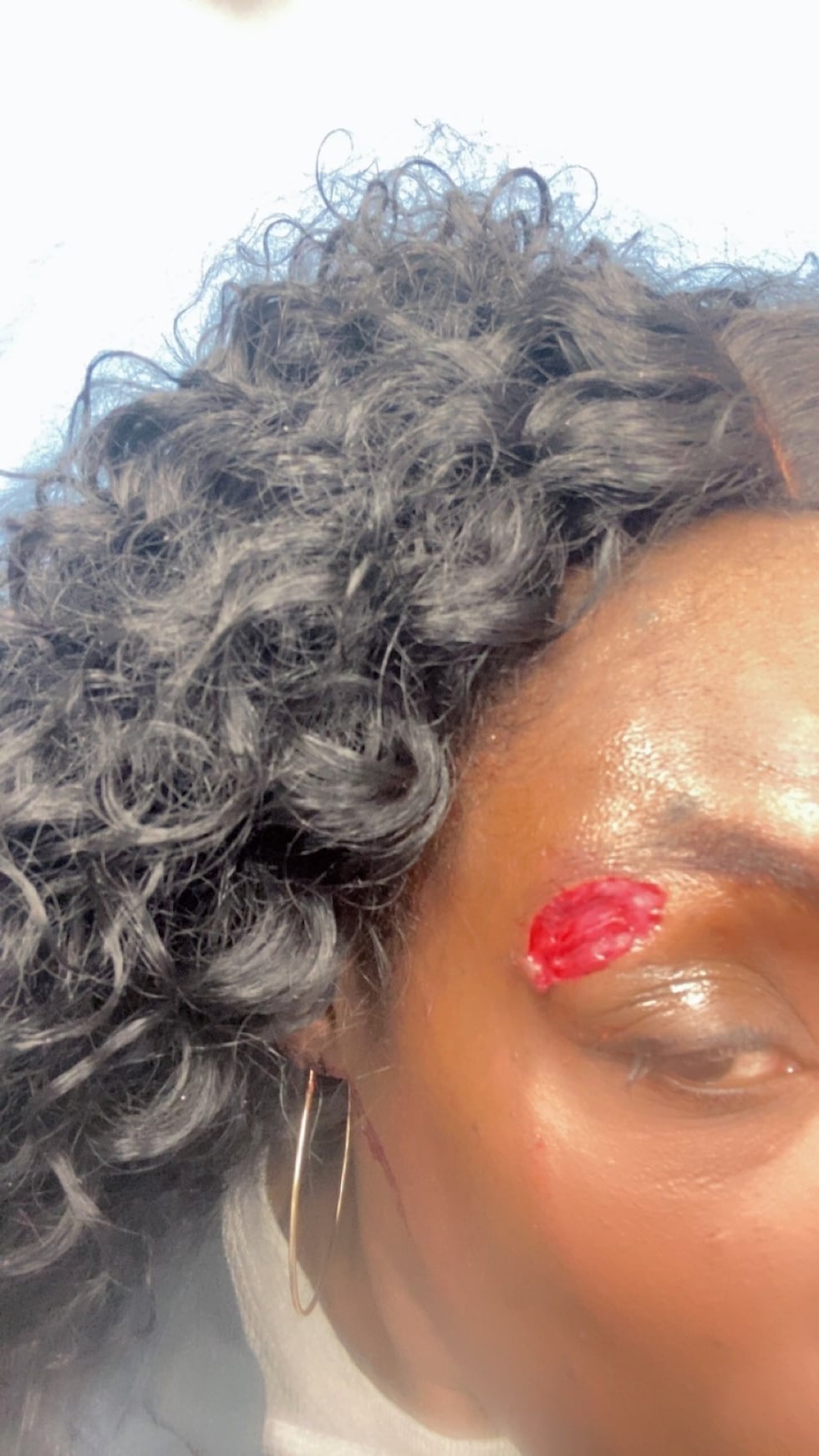 Female inmate bites off portion of detention officer’s face in Rankin County