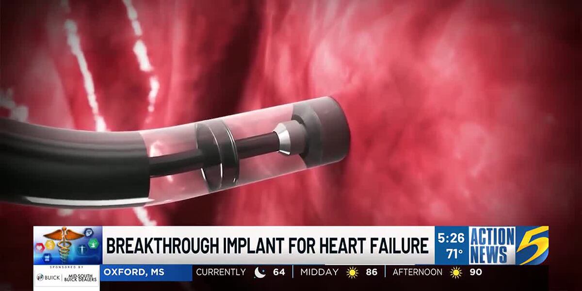 Best Life: Breakthrough implant for heart failure