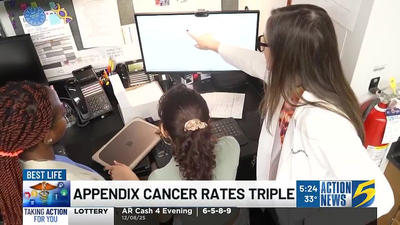 Rare But Rising: Appendix Cancer Rates Triple