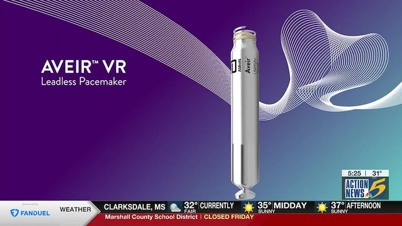 Best Pacemaker Best Life: New wireless pacemaker shocking hearts back into rhythm