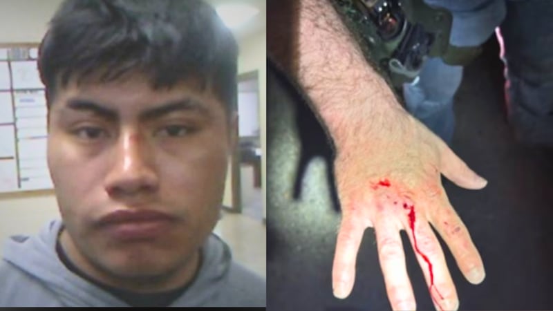 Authorities say Maximiliano Perez-Perez attempted to escape officers during his arrest and bit...